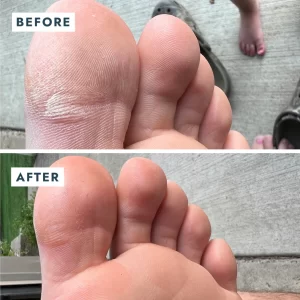 Voesh Solemate Heel Repair Balm