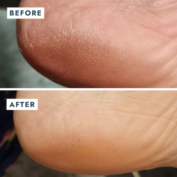 Voesh Solemate Heel Repair Balm